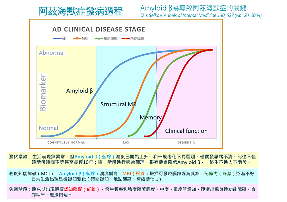 阿茲海默症AD發病過程