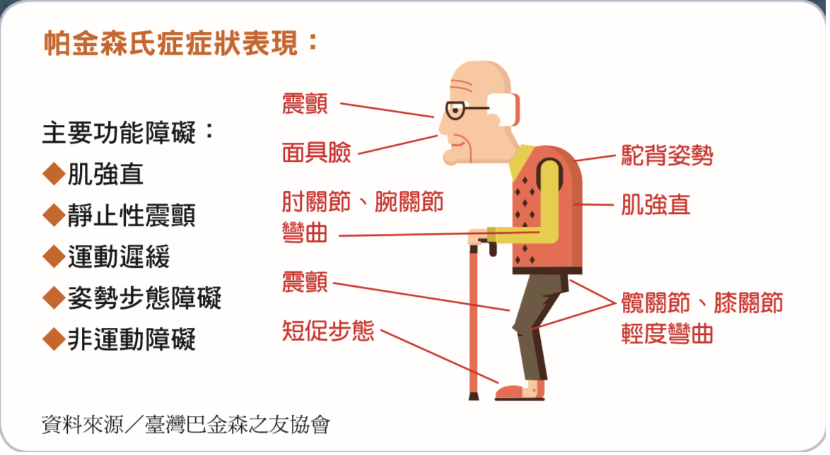 帕金森氏症表現(Parkinson's disease, PD)